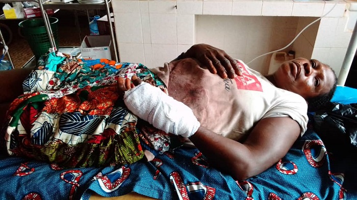 Un bras coupé, une victime de plus à Agbozo-Kpedzi : Arrêter la spirale de bouviers assassins